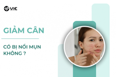 GIẢM CÂN CÓ BỊ NỔI MỤN KHÔNG  ? 